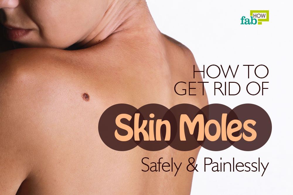 How to Get Rid of Moles Safely and Painlessly Fab How