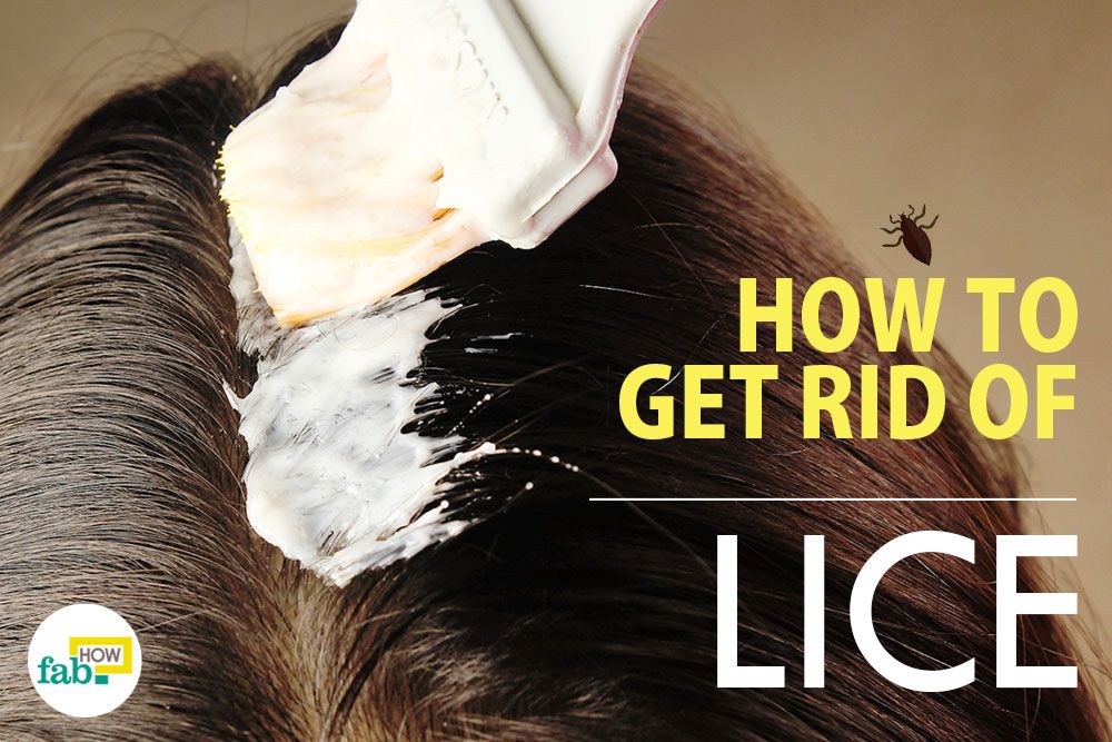 How to Get Rid of Head Lice Fast - Home Remedies For Lice