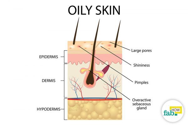get rid of oily skin