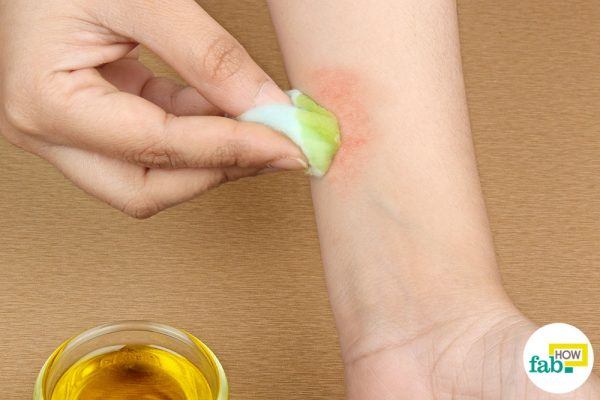 olive oil for rashes