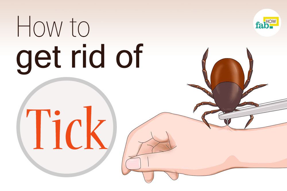 how to get rid of a tick
