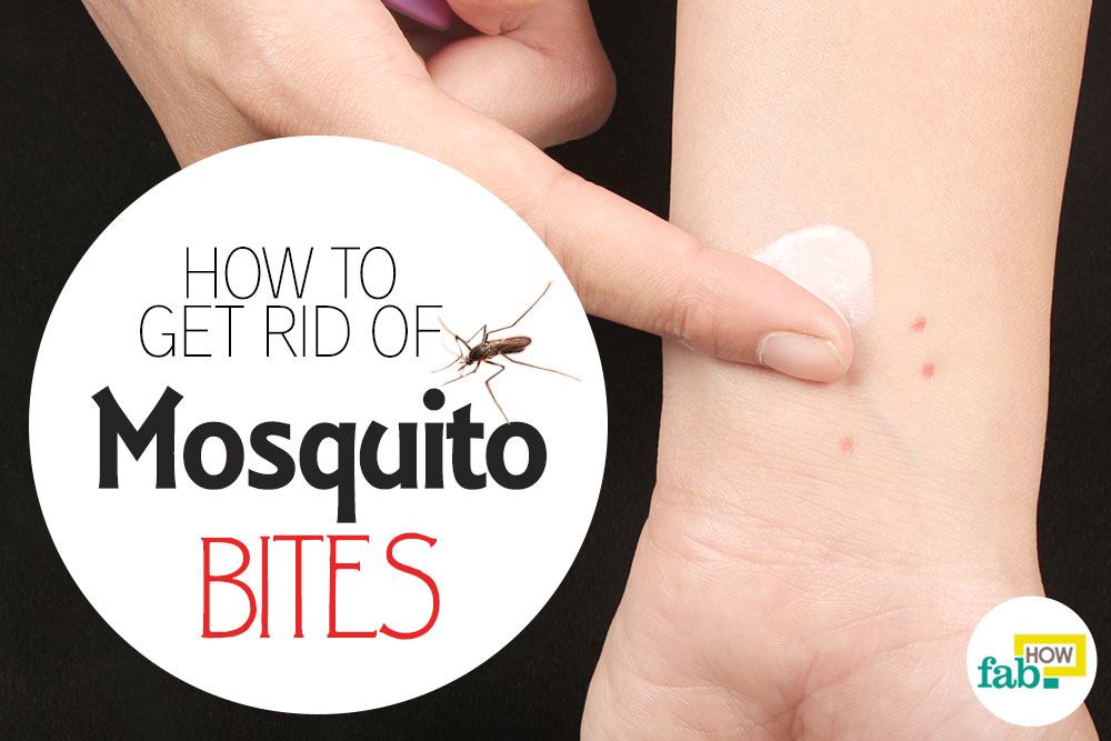 get rid of mosquito bites