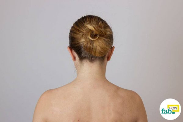 How to Get Rid of Back Acne