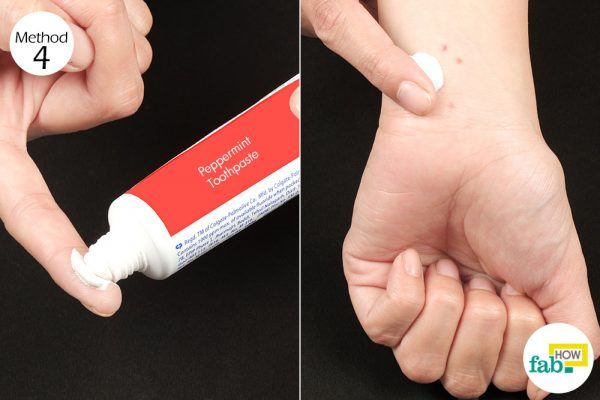 peppermint toothpaste to treat mosquito bites