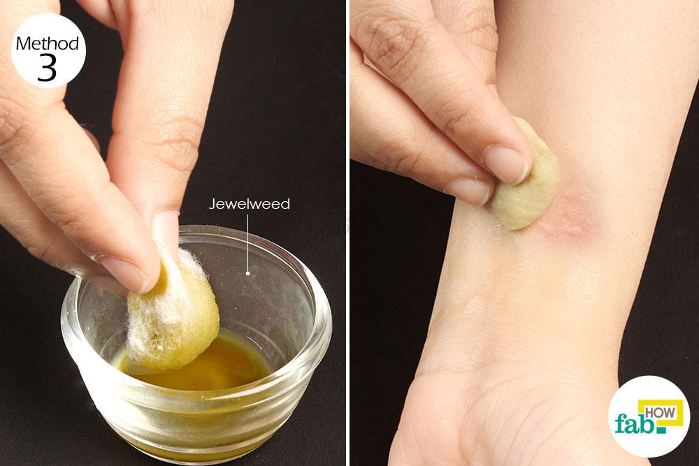 Can You Pop Poison Ivy Blisters Natural Remedies For Poison Ivy Rash Treatment Fab How