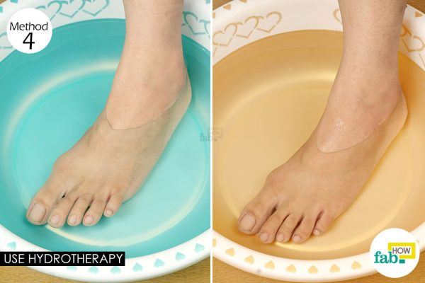 hydrotherapy to get rid of chilblains