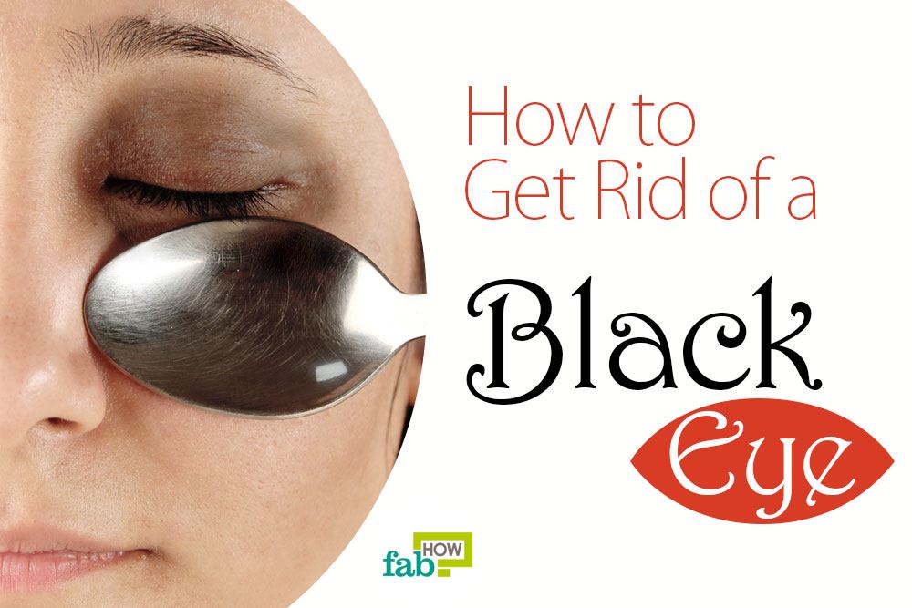 get rid of black eye