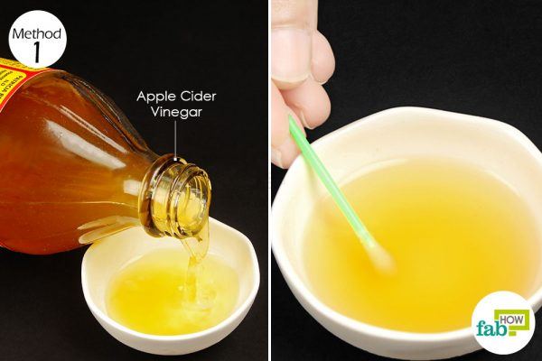 use apple cider vinegar to treat herpes