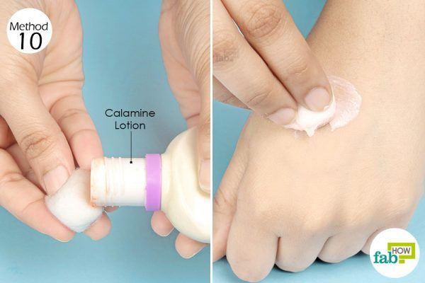 use calamine lotion to treat a bee sting