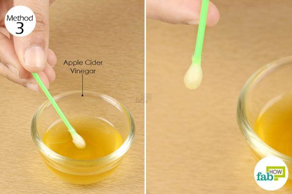 apply apple cider vinegar on the canker sore