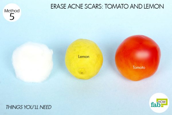 things you'll need to use lemon for acne scars