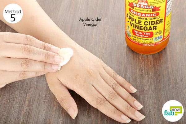 Apply raw, unfiltered apple cider vinegar to get rid of itchy skin