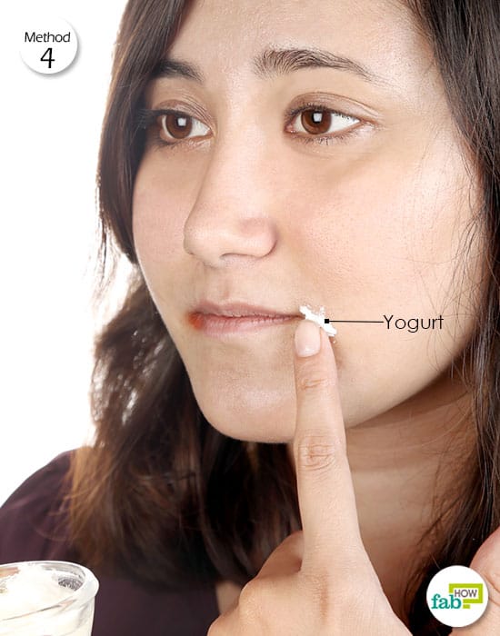 Apply plain yogurt containing good bacteria over the affected area to get rid of angular cheilitis
