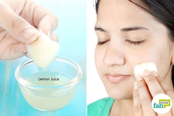 Apply undiluted lemon juice over acne-affected areas to use lemon for acne