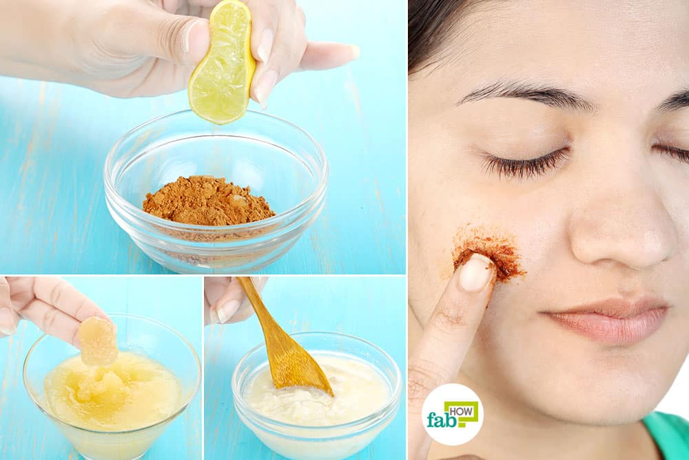 How to Use Lemon for Acne