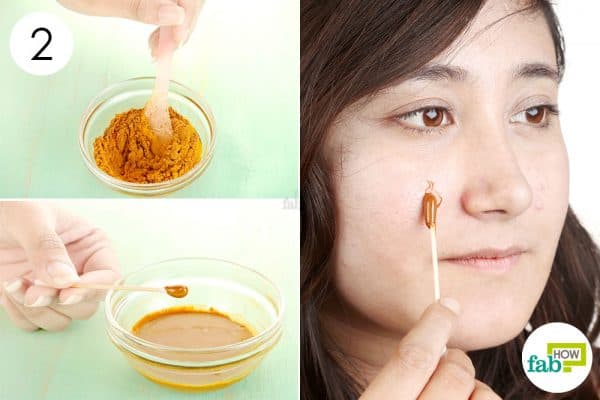 Mix well and apply to use cinnamon for acne