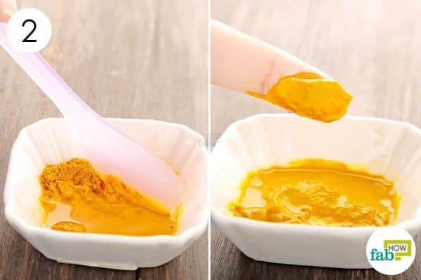 Use turmeric for health-apply the paste to get rid of acne inversa