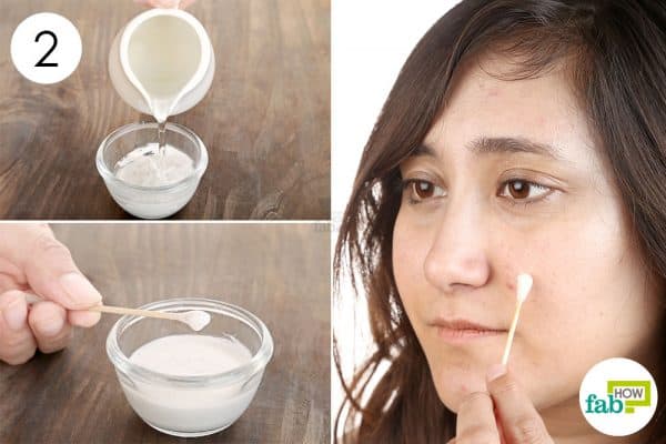 Add some water to form a paste of baking soda for acne