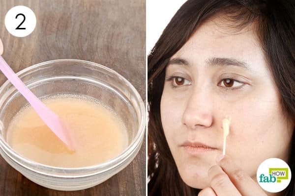 Mix well and use baking soda for acne