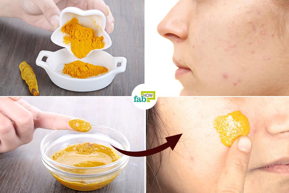 How to use turmeric to get rid of scars