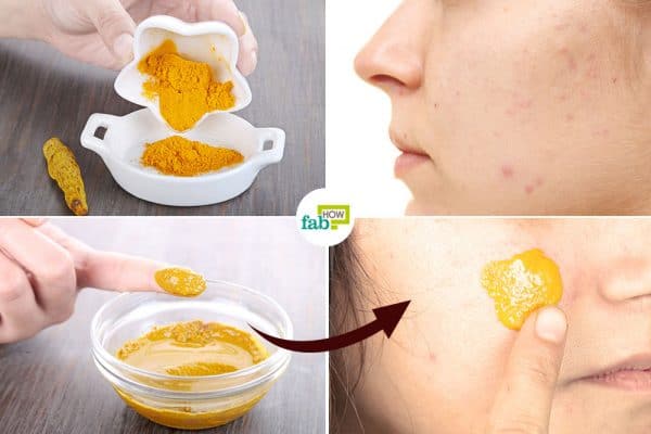 Use turmeric to get rid of scars naturally