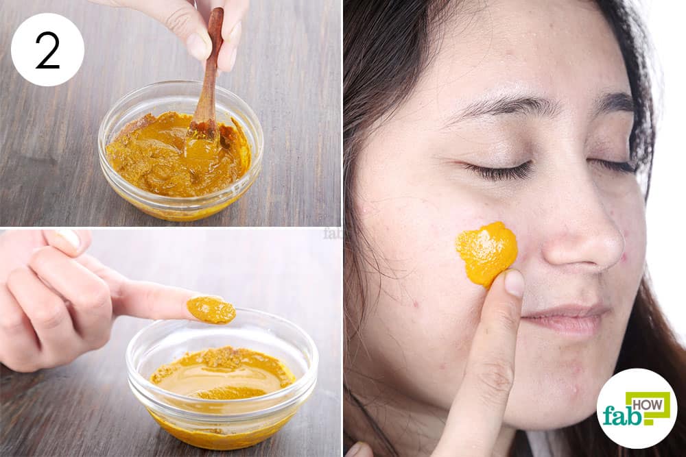 Mix and apply to use turmeric to get rid of scars