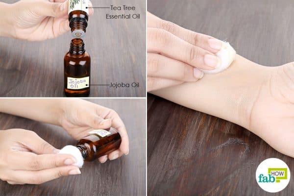 use tea tree oil for fungal infections-to treat ringworm