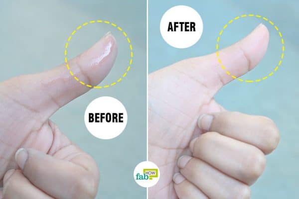 ært sum Præsident How To Remove Super Glue From Skin: 4 Methods That Work 05/2023