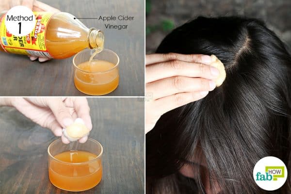 massage vinegar on scalp to use acv for dandruff
