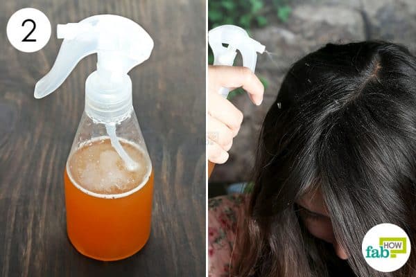 spray on scalp to use acv for dandruff