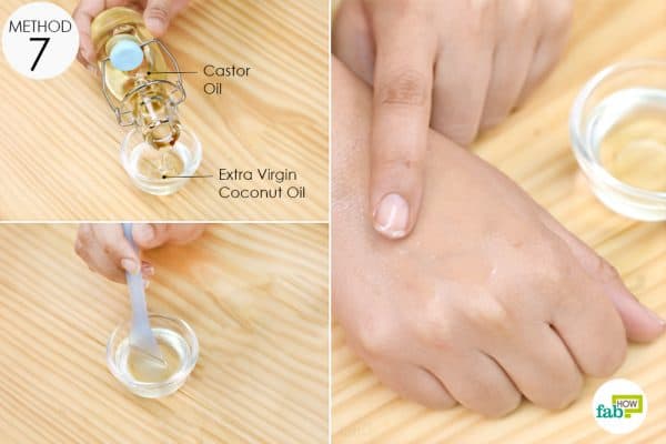 mix castor oil with extra virgin coconut oil to apply on the affected area