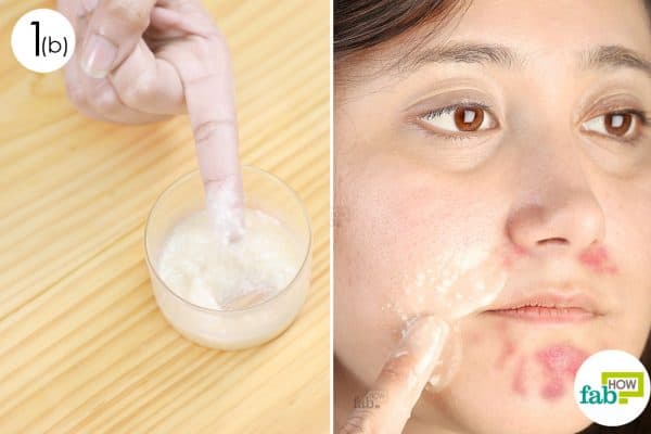apply to use olive oil remedy for skin disorder