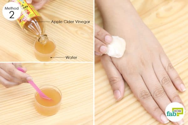 apply diluted apple cider vinegar