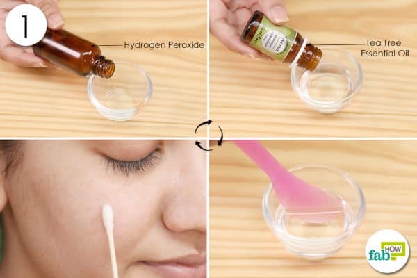mix ingredients to use hydrogen peroxide for acne