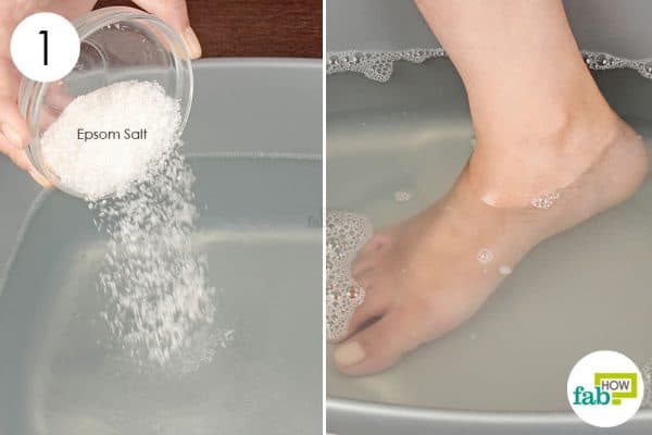 soak your feet in epsom salt bath
